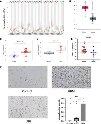 GNG12 as A Novel Molecular Marker for the Diagnosis and Treatment of Glioma